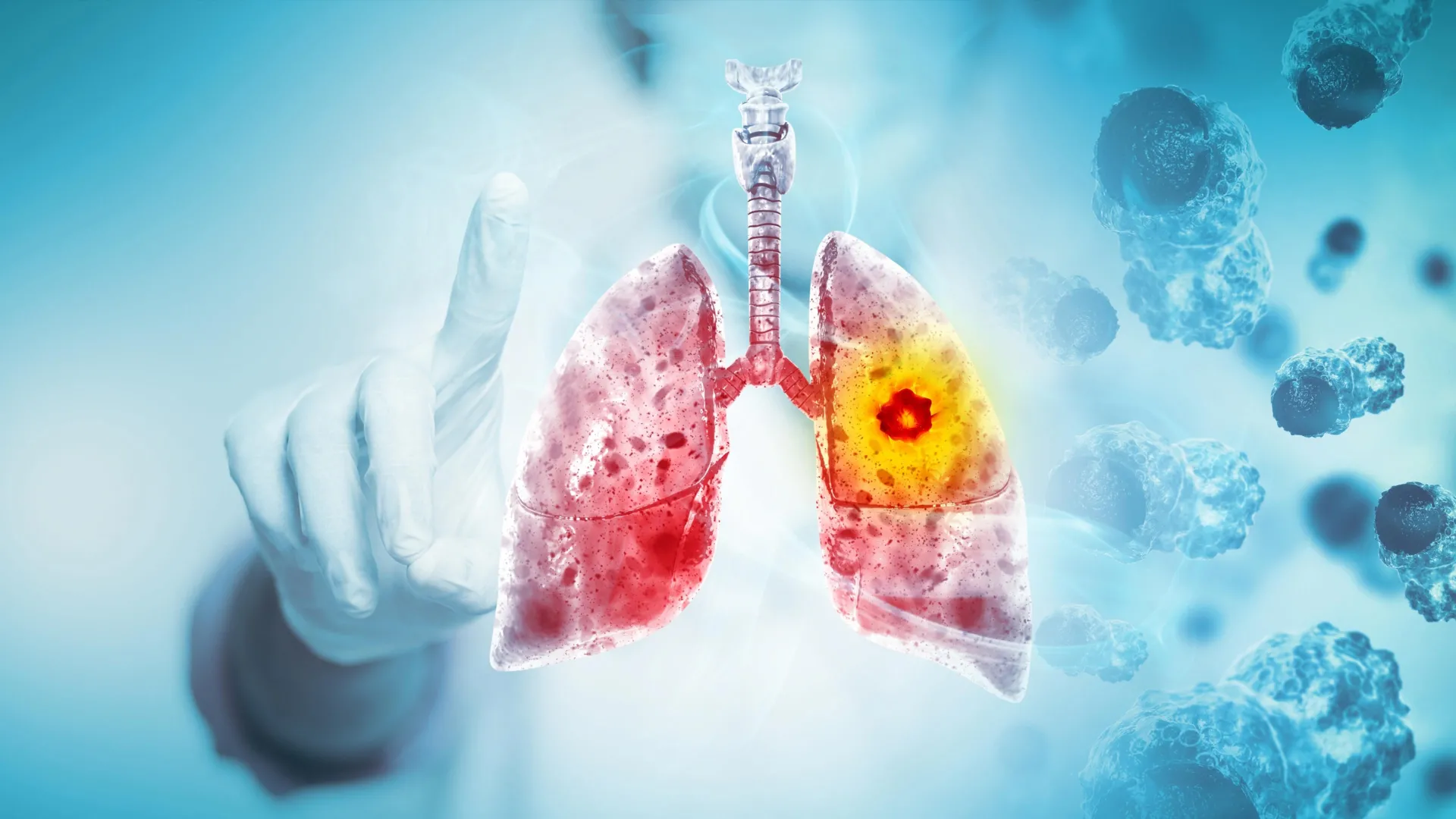 svapo sotto accusa revisione scientifica rischio tumori ai polmoni e orale da Cibosia.it svapo sotto accusa revisione scientifica rischio tumori ai polmoni e orale